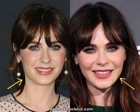 Zooey Deschanel Plastic Surgery: Facts and Myths ...